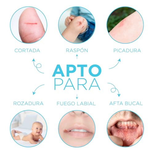 TRIOXIMED | Aceite Ozonizado Oliva O3 15 Ml | Puede ser utilizado por toda la familia | Mejora lesiones superficiales como: hongos, virus. encías, bacterias, rozadura pañal, raspones, picaduras de mosquitos, cortaduras, aftas, lesiones bucales, gingivitis