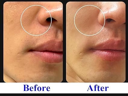 Suero regenerador excepcional: reafirma, da volumen y revitaliza con SCM, 5% de volufiline, colágeno T1 y PHA (30 ml, 1 oz)