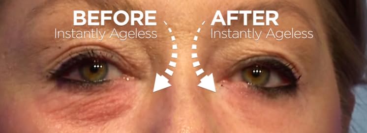 Instantly Ageless 5 Ampolletas. Antiarrugas Instantaneo y Antiojeras