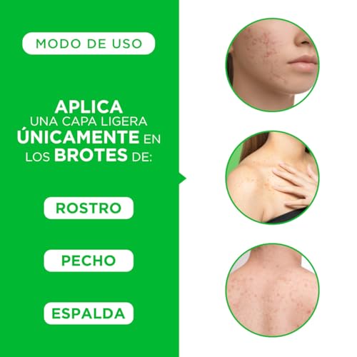 TRIOXIMED Antiacné | Controla y previene lesiones de acné, espinillas, granos, barros | Facial y Corporal | Aceite de Girasol Ozonizado