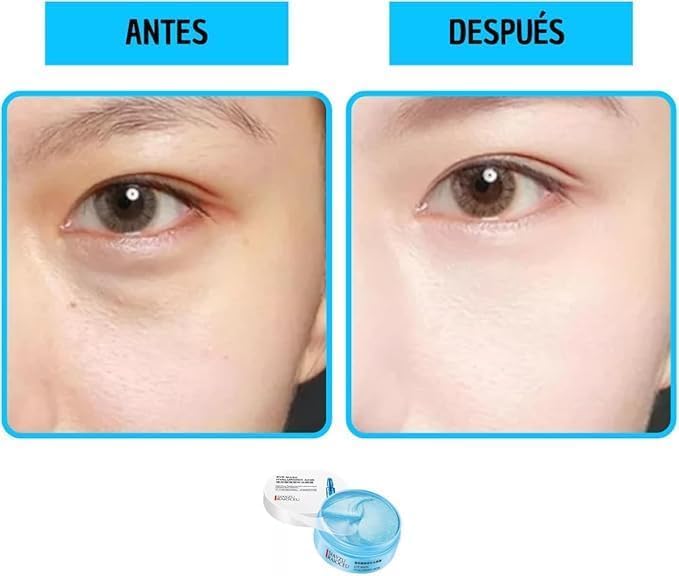 Parches Ojos Acido Hialuronico, Mascarilla Para Ojeras Y Bolsas, Contorno De Ojos, Hidrogel Anti Arrugas, Lineas De Expresion, Hinchazon, Parches Humectantes, Optigel, Eye Patches (2 unidades)