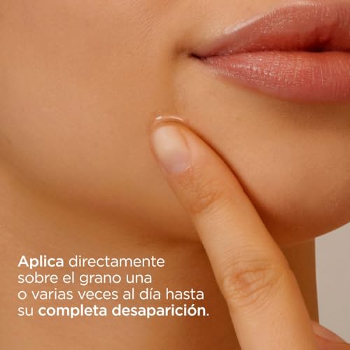 ISDIN Teen Skin Acniben Corrector de Granos Faciales - 15 ml, 1, 1 unidad, 1