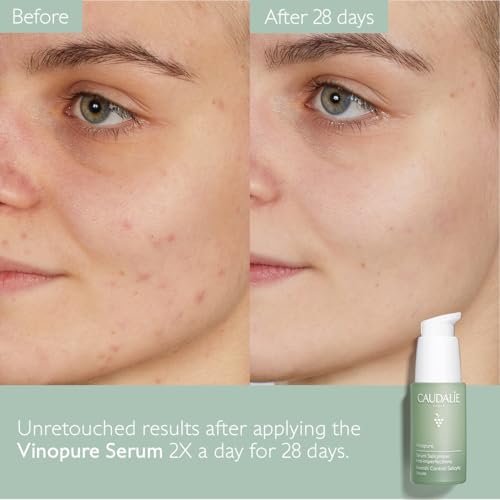 Caudalie Vinopure Sérum 30 ml