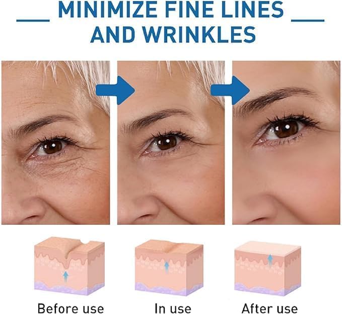 Suero facial Hyalu B5 de ácido hialurónico puro 5 Pcs | Sérum antiarrugas y antienvejecimiento | Hidratante y humectante | 30ml/1.01fl.oz