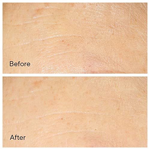 Murad - Kit Instant line and firming fixes