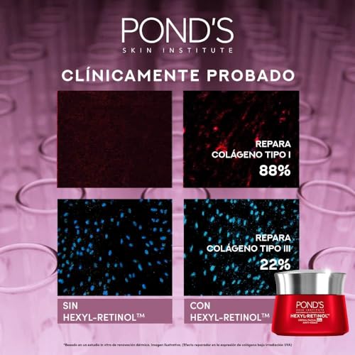 PONDS Crema Facial Antiedad Día Age Miracle Ultimate Youth con Hexyl-Retinol para una piel más firme, luminosa y joven, disminuye las líneas de expresión y las manchas* 50 g