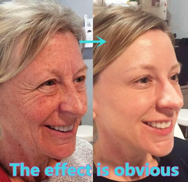 Glutathione Face Serum with Niacinamide and Hyaluronic Acid - Enhance Skin Elasticity, Anti-aging - 30ML/1FL.OZ (1/2/3PCS)