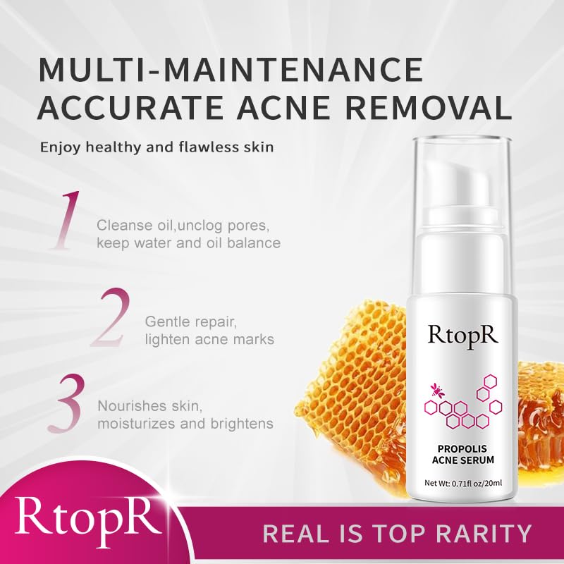 RtopR Propolis Repair Acne Serum, Suero Hidratante Anti-Acné para Eliminar el Acné Severo, Brotes, Granos y Reparar la Piel