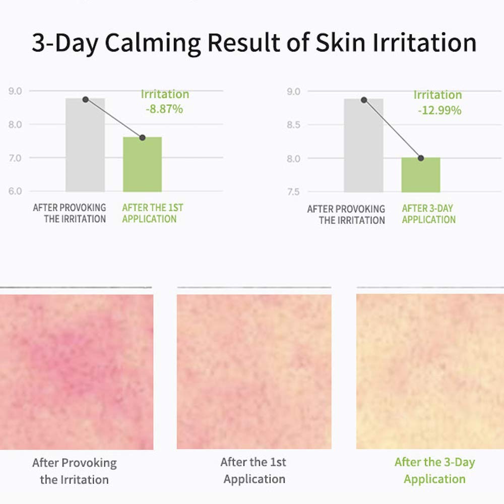 celimax- La verdadera crema reparadora energética de noni | con ceramidas, humectante, calmante, hidratante, antienvejecimiento,
