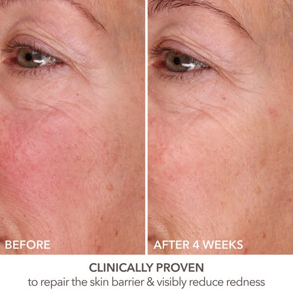 Sérum DermInfusions Fill Plus Repair Dr. Dennis Gross 1 oz para Mujer