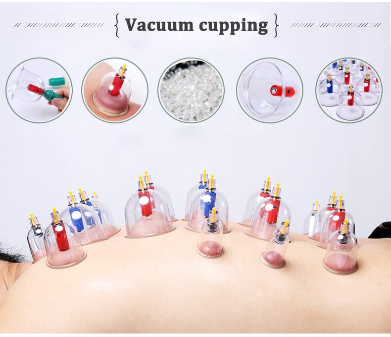 Juego de Terapia Biomagnética Kangzhu Chino con 24 Tazas