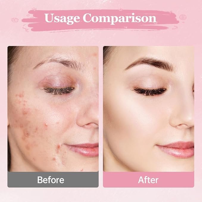 Toallas Desmaquillantes con Cúrcuma - Pads de Limpieza Facial Innovadores - Pack de 40/80/120 unidades - Esponjas Faciales Comprimidas - ¡Desmaquilla y Limpia Profundamente!