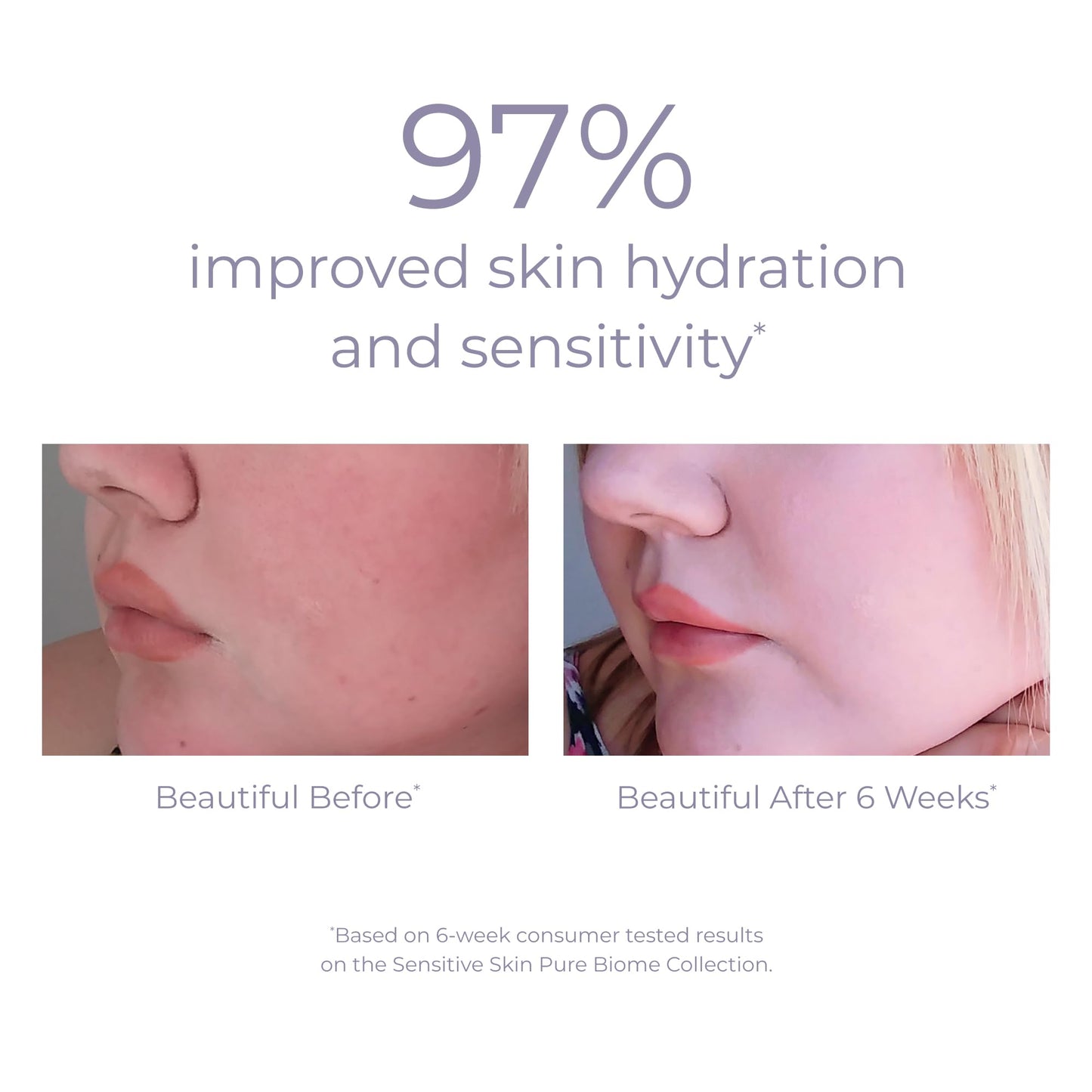 Derma-E Sensitive Skin Moisturizing Cream for Unisex 2 oz Cream