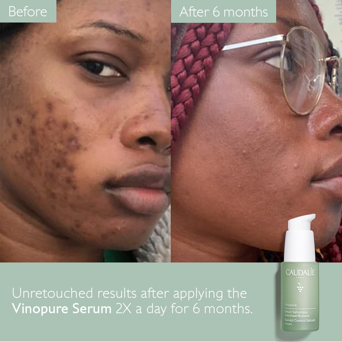 Caudalie Vinopure Sérum 30 ml