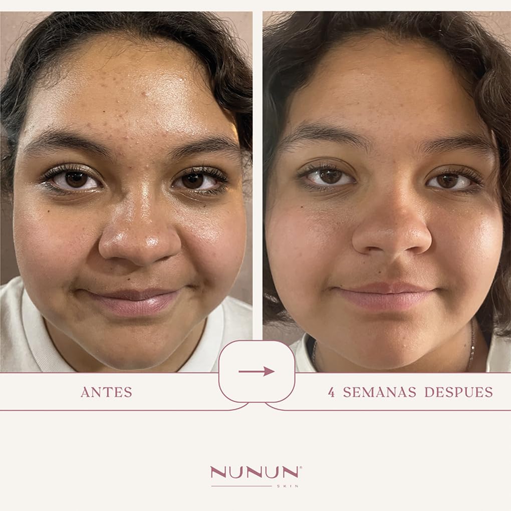 NUNUN SKIN Set Oil Control , Skin Care Control de Cutis graso