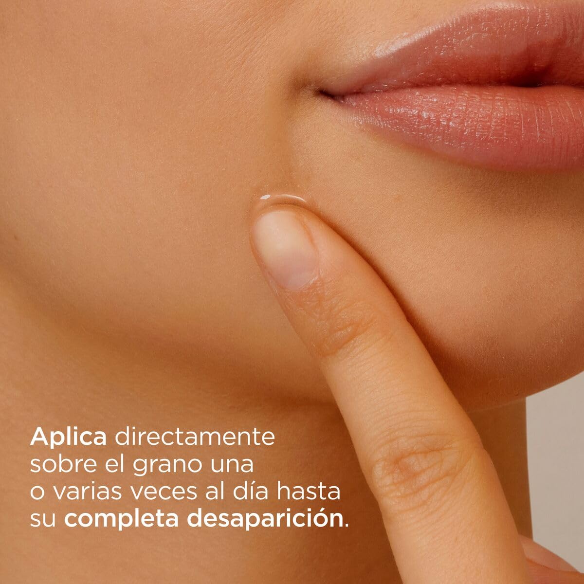 ISDIN Teen Skin Acniben Corrector de Granos Faciales - 15 ml, 1, 1 unidad, 1