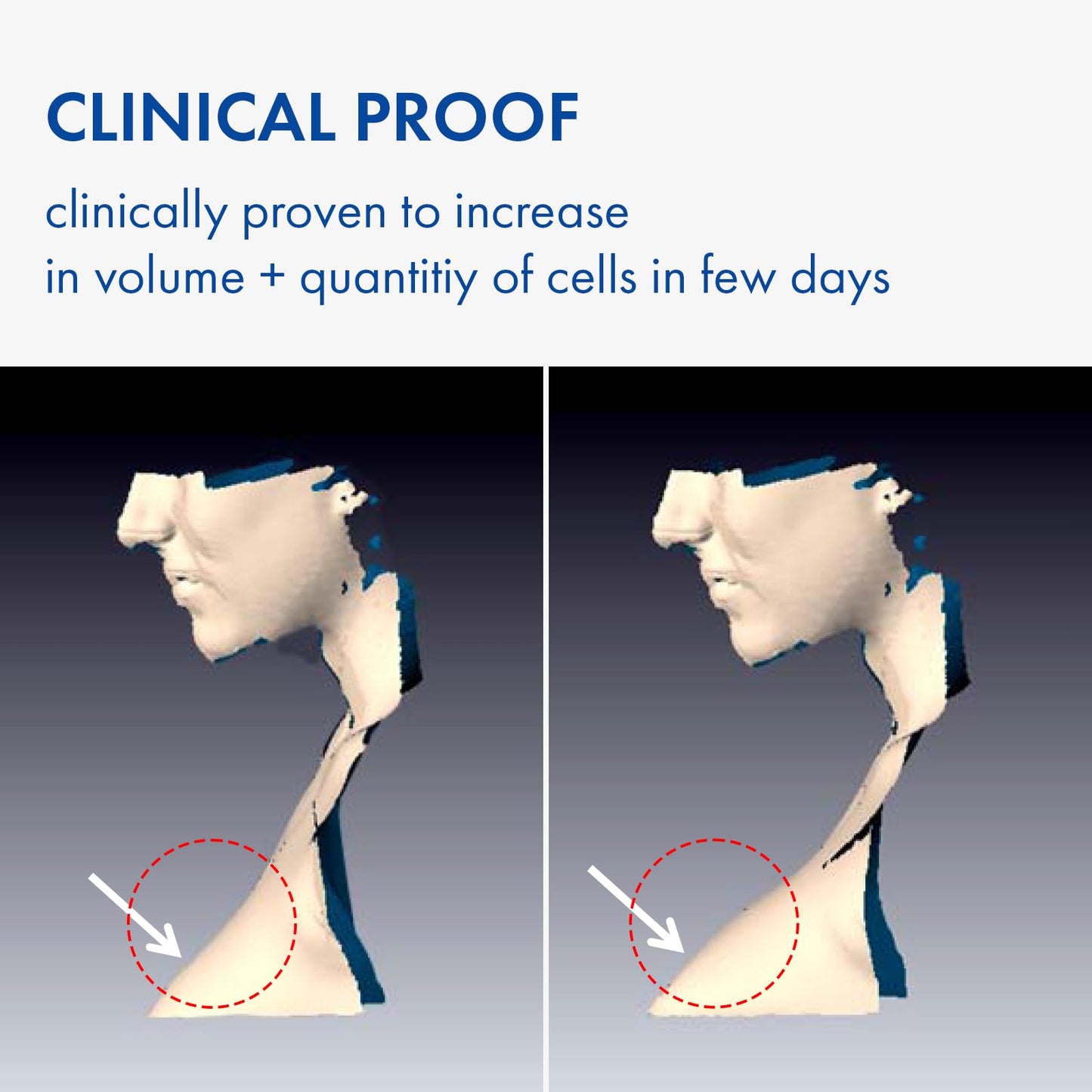 Suero Concentrado Sederma Francia Volufiline para Realzar y Reafirmar Piel