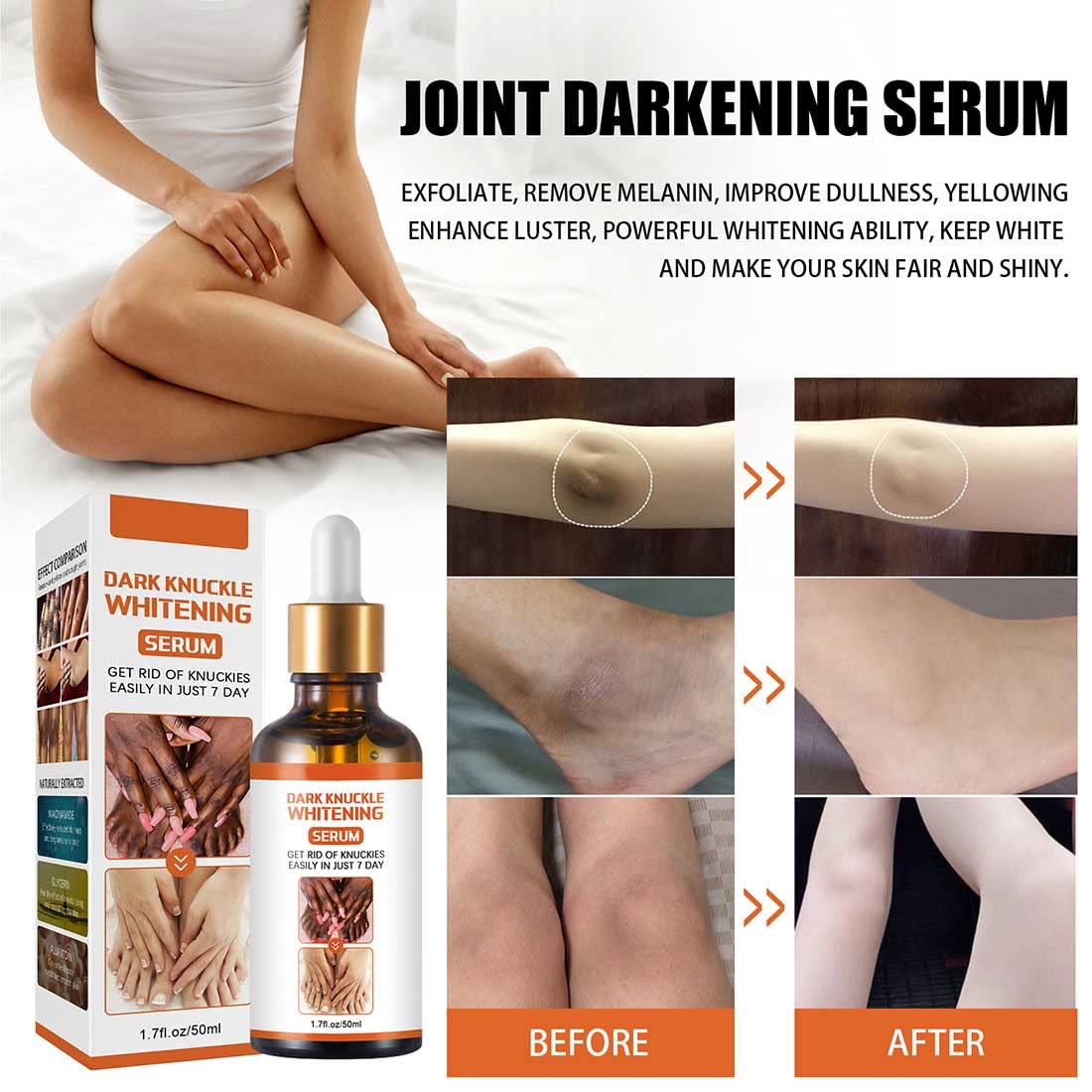 Suero Blanqueador Aceite Aclarante para Manchas Oscuras en Cuerpo y Nudillos Piel Negra Rodillas y Codos