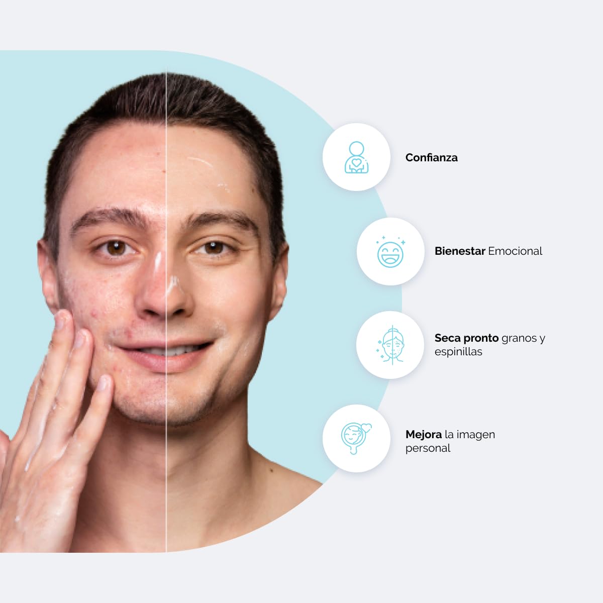 BPO LLEN Gel Limpiador Facial Anti-Acné con Peróxido de Benzoilo | Tratamiento Anti-Imperfecciones | Antiseborreico y Antiséptico | Indicado para Combatir el Acné Leve o Moderado | 60 ml (Peróxido de Benzoilo 2,5%)