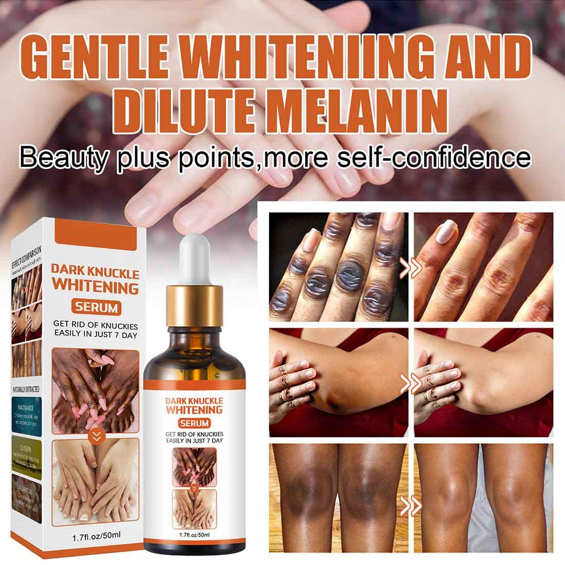 Suero Blanqueador Aceite Aclarante para Manchas Oscuras en Cuerpo y Nudillos Piel Negra Rodillas y Codos