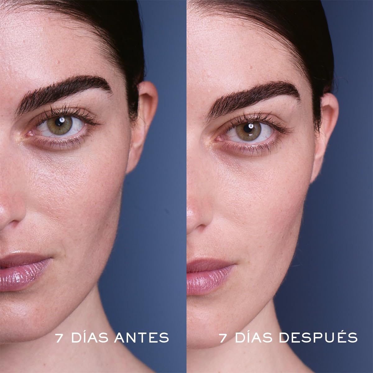 Lancôme Advanced Génifique Serum, Suero Reparador Para Rostro De 50Ml