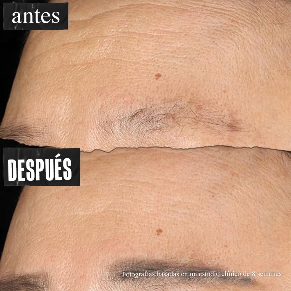 Kiehl's Super Multi-Corrective Face Cream, Suave Crema Hidratante Facial, Antienvejecimiento Para Pieles Grasas y Sensibles, Restaura la Firmeza, Con Proxylane y Adenosina, 75 ml