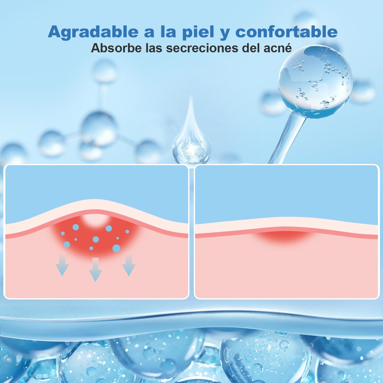 Parches para Acne,Pimple Patch,200 Almohadillas Hidrocoloides para Espinillas, Parches para Espinillas, Pimple Reduce Enrojecimiento,Forma de Estrella, Pueden Absorber la Secreción (Rojo)