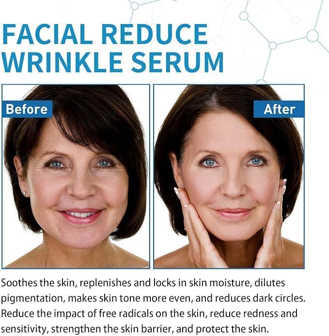 Suero facial Hyalu B5 de ácido hialurónico puro 5 Pcs | Sérum antiarrugas y antienvejecimiento | Hidratante y humectante | 30ml/1.01fl.oz