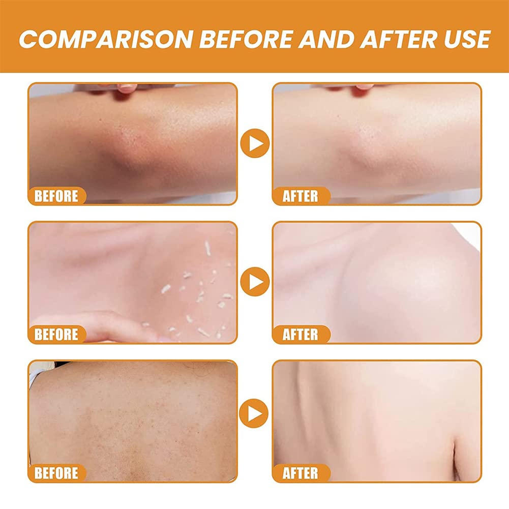 Kwiphiny Gmeelan Orange Exfoliating Whitening Gel, Orange Exfoliating Gel Scrub Face Body Skin Whitening, Deep Cleaning Exfoliating Whitening Gel (2PC)