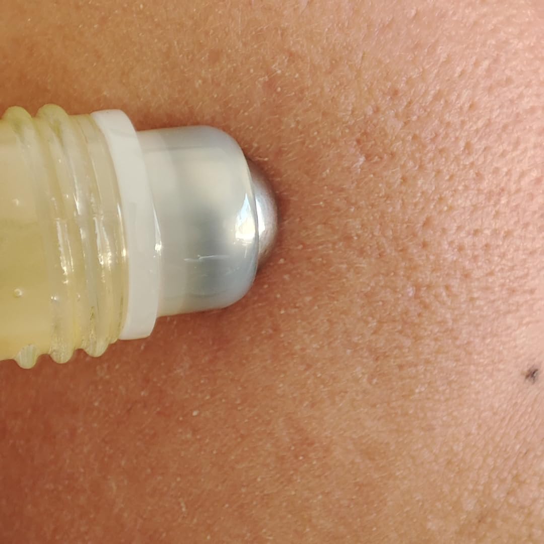 Secador de Barros Roll On SOS con Aceites Esenciales y Alfa y Beta Hidroxiácidos