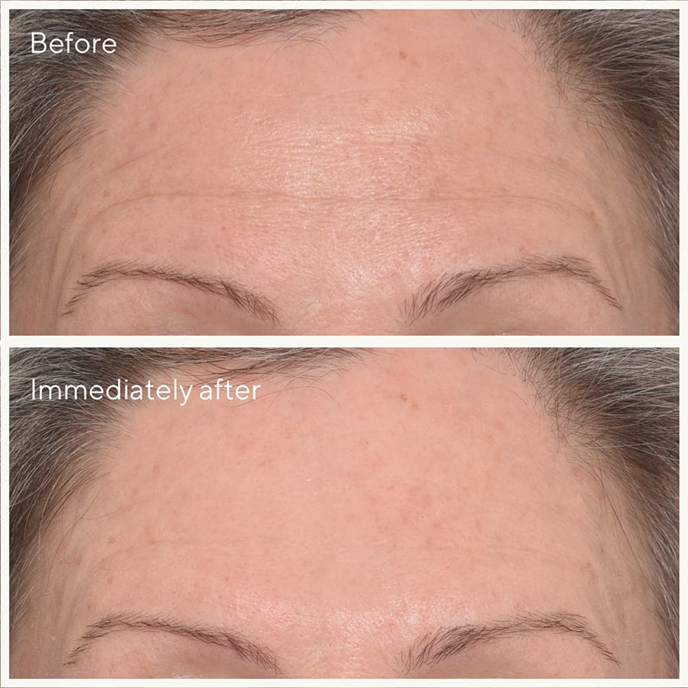 Murad - Kit Instant line and firming fixes