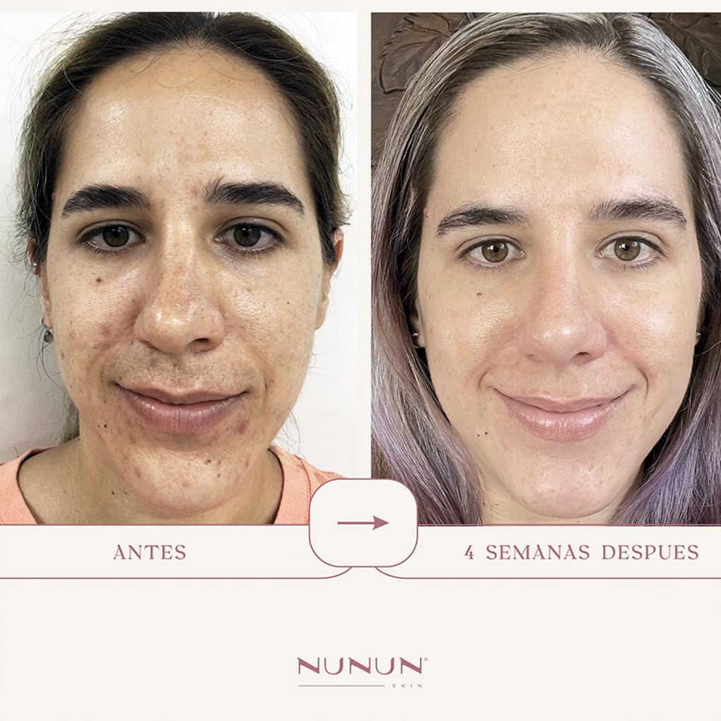 Set Antiedad Nunun Skin Cuidado en Piel