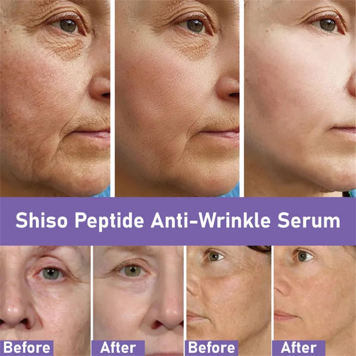 Duo Serum Cuidado Facial Perilla Y Sea Fennel Bioaqua Skin ácido hialurónico Esencia Hidratante Facial Polipéptido Perilla Anti-Envejecimiento Reparación Sérica Nutritivo Antiarrugas