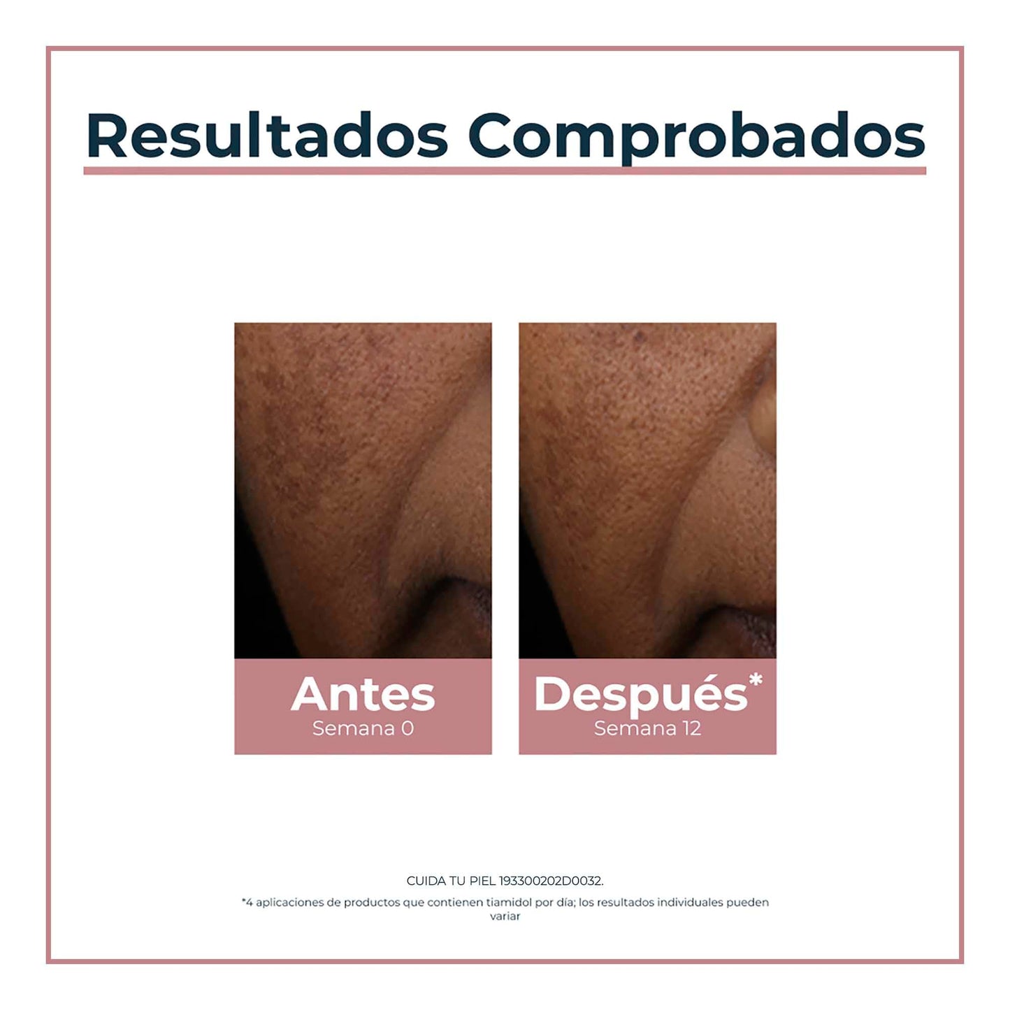 Eucerin Lápiz corrector anti manchas Anti Pigment Spot Corrector, 5ml