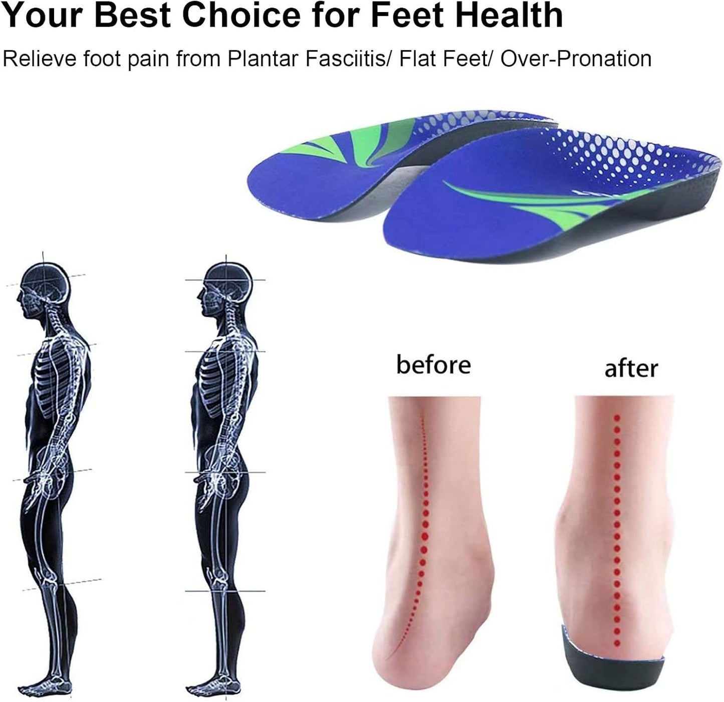 Insertos ortopédicos de longitud 3/4, plantillas de soporte de arco alto para sobrepronación, fascitis plantar, pies planos, insertos de zapatos para caminar, correr hombres y mujeres