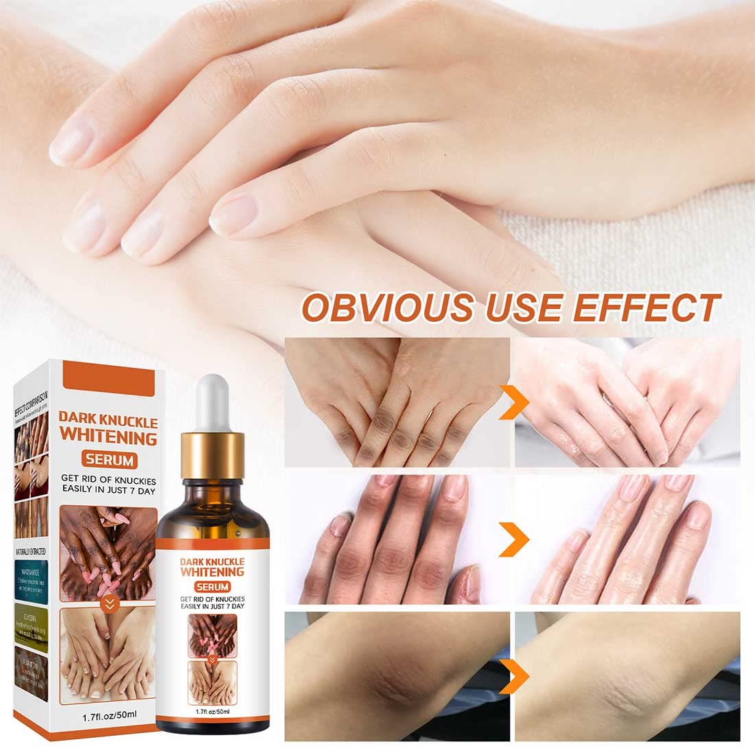 Suero Blanqueador Aceite Aclarante para Manchas Oscuras en Cuerpo y Nudillos Piel Negra Rodillas y Codos