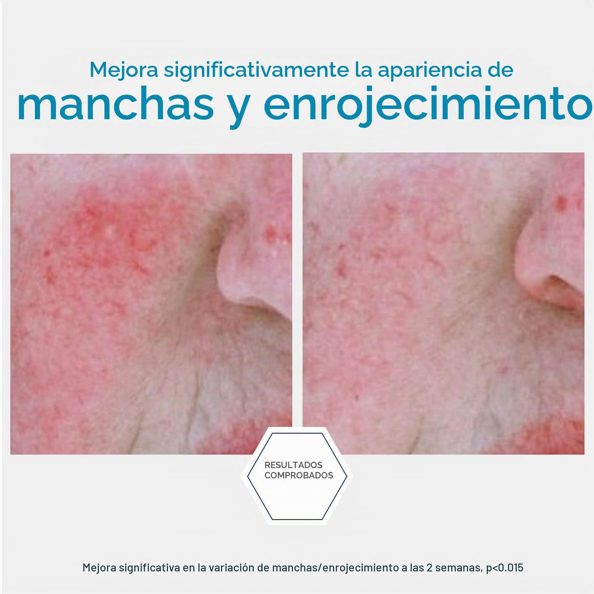 Neostrata Reactive Skin Neutralizante Concentrado Calmante, Hidratante y Enfriante para la Cara Libre de Aceite sin Fragancia, 1.02 Oz.