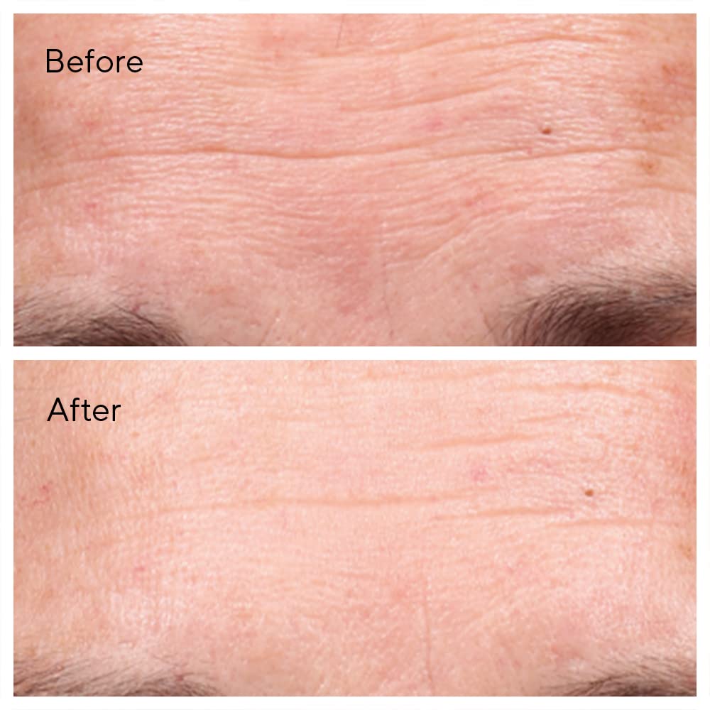 Murad - Kit Instant line and firming fixes