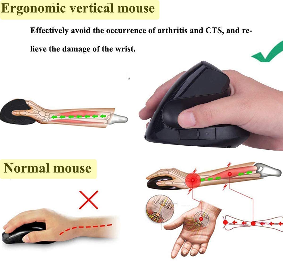 Mouse Ergonómico Inalámbrico Óptico Vertical con Receptor USB 2.4GHz para Mac y Windows