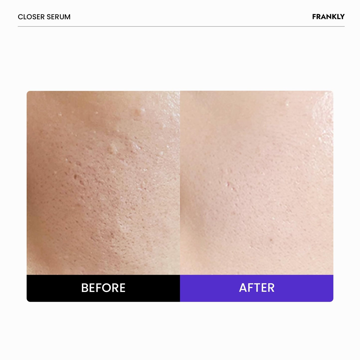 Suero Frankly Closer Mega Jumbo 3,38 fl.oz. Minimizador de poros, antienvejecimiento, elasticidad, hidratación, piel tersa | 9 péptidos, colágeno vegano, PHA | No comedogénico y dermatológicamente