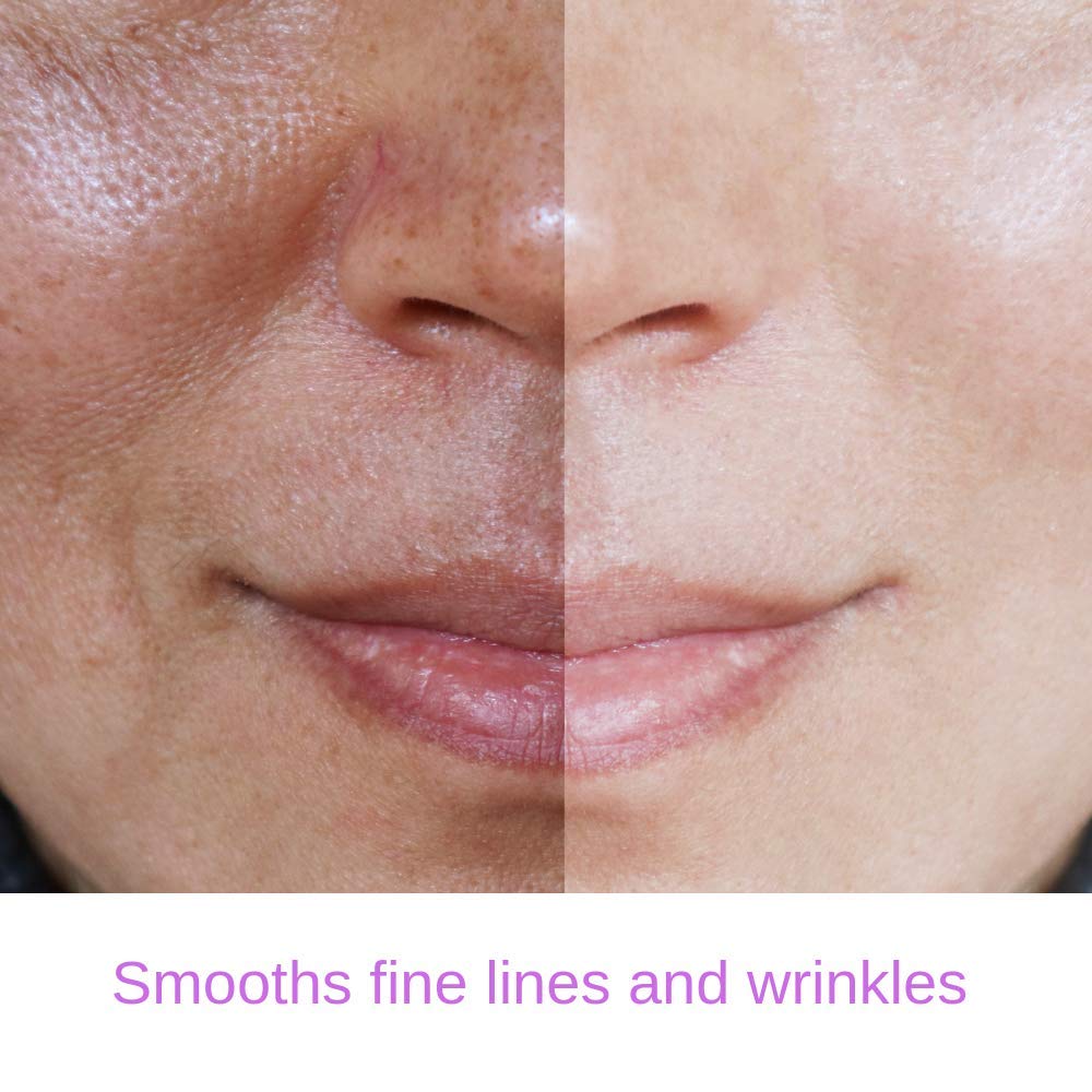 RETINOL 2.5% Serum, Professional Strength Anti- Aging Formula With Hyaluronic Acid and Vitamin E by Essence of Arcadia, Minimize Wrinkles, Fade Dark Spots