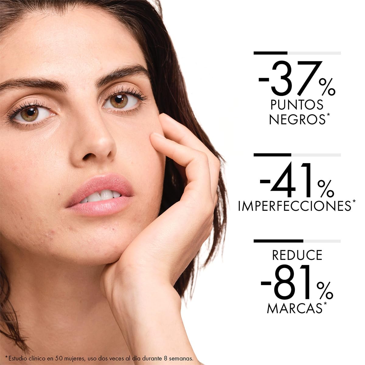 Tratamiento de Doble Corrección para Pieles con Tendencia Acnéica Vichy Normaderm Phytosolution 50ml