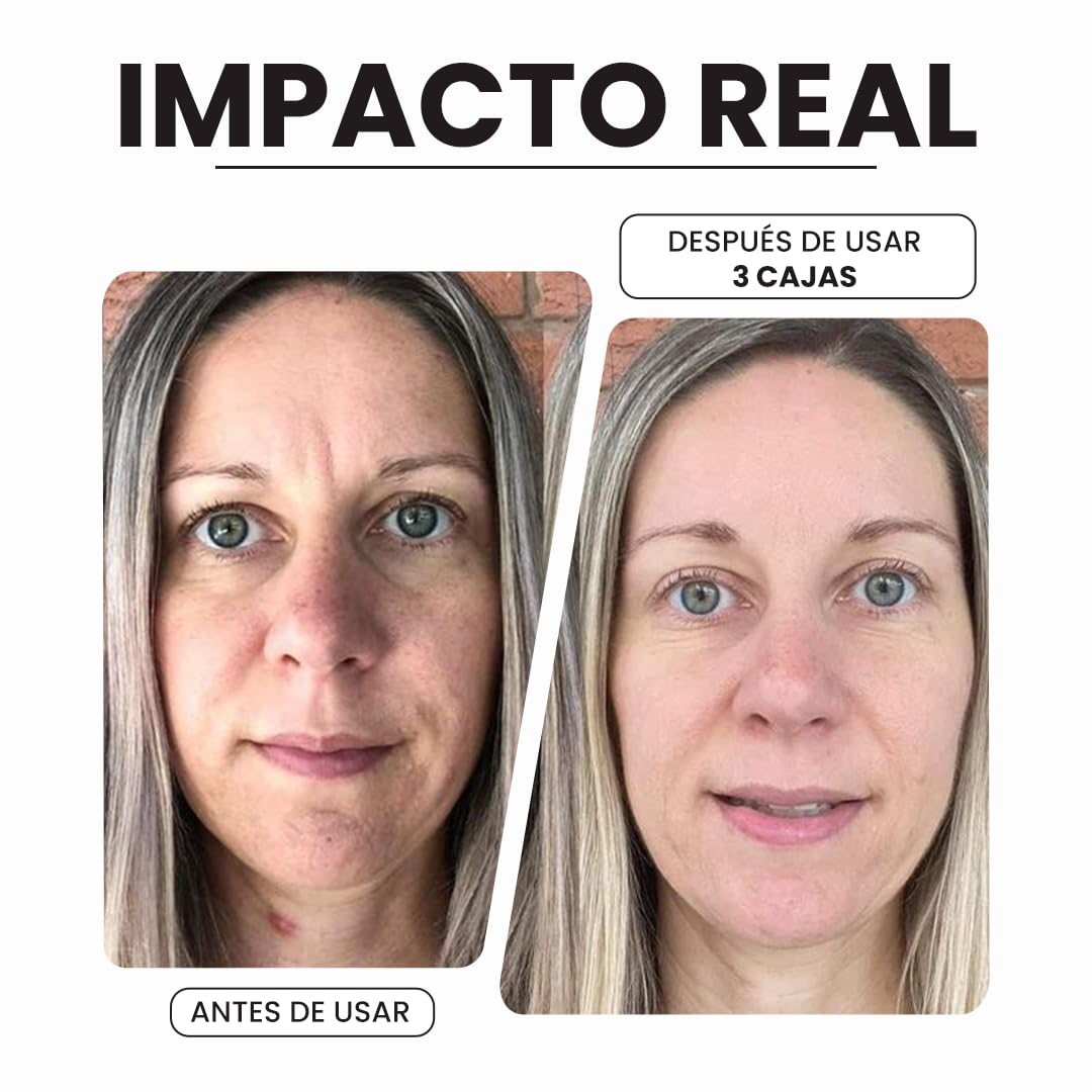 Seyoul™ DoC Retinol (1% Retinol), rejuvenecimiento de la piel, decoloración de las manchas oscuras, tono uniforme de la piel, 40 boidegradable capsules