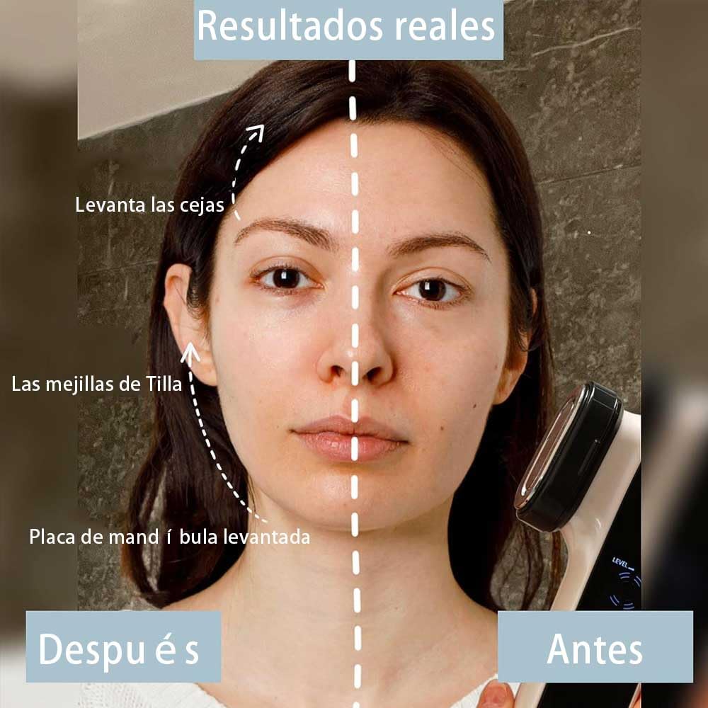 Mini Máquina HIFU, Masajeador Facial para Antiarrugas y Reafirmante, 5 EN1 Pro Maquina Estetica Antienvejecimiento, Dispositivo Ultrasónico EMS por Radiofrecuencia, Anti Envejecimiento, Cuidado Facial con Frío Calor Roja y Azul (Blanco)
