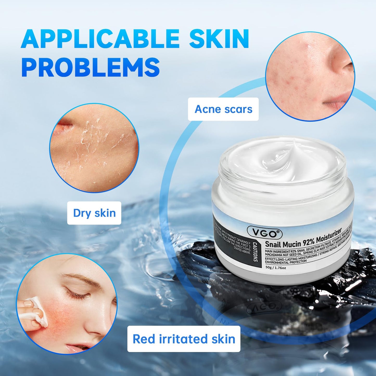 VGO-Crema hidratante facial de uso diario con mucina de caracol al 92% en gel reparador e hidratante para pieles secas y sensibles, todo tipo de pieles, 50 g/1,76 oz