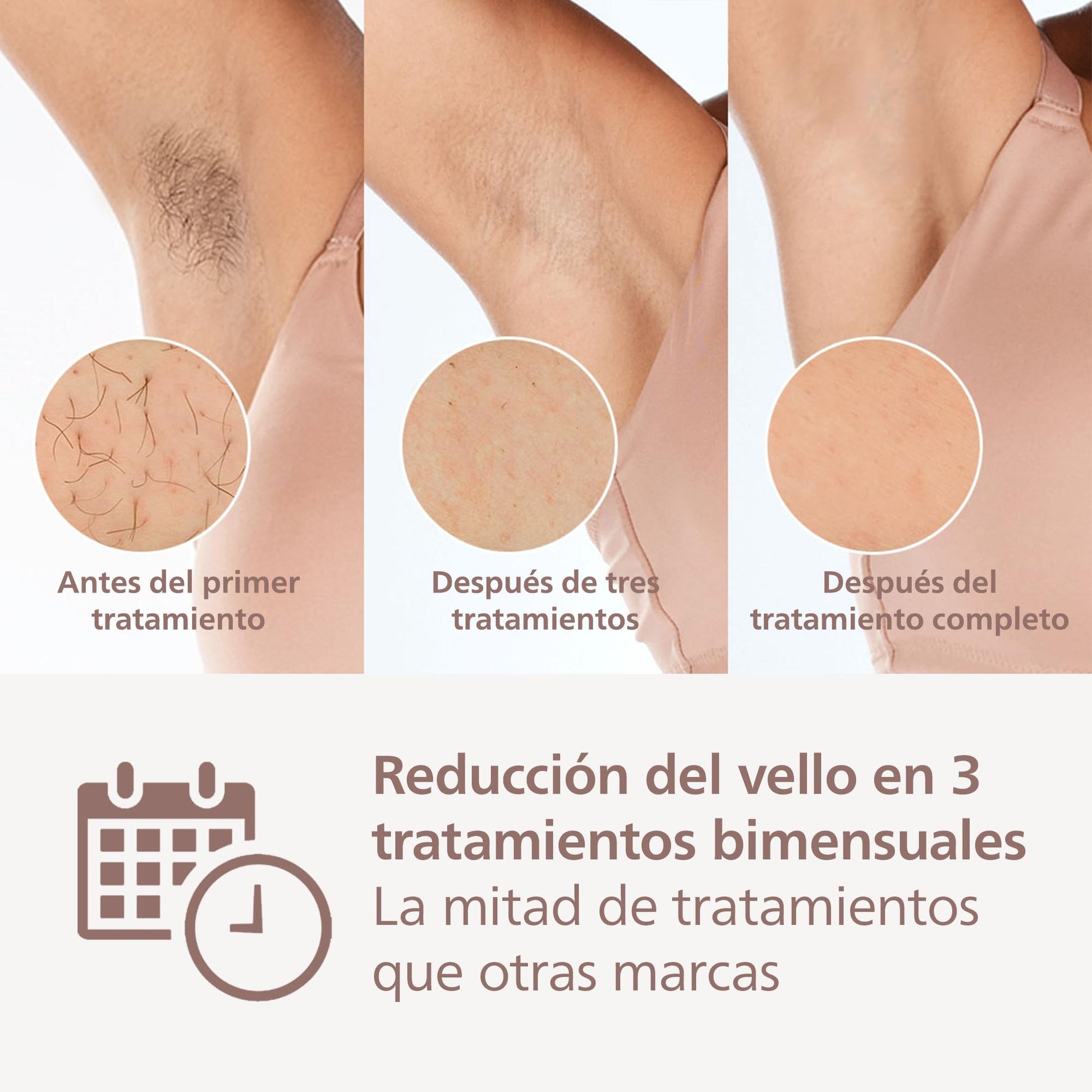 Philips Lumea Prestige Depiladora IPL, Luz Pulsada, inalámbrica, 4 Cabezales Inteligentes (Cuerpo, Bikini, Axilas y Cara) y SmartSkin Sensor, Rosa BRI958/00