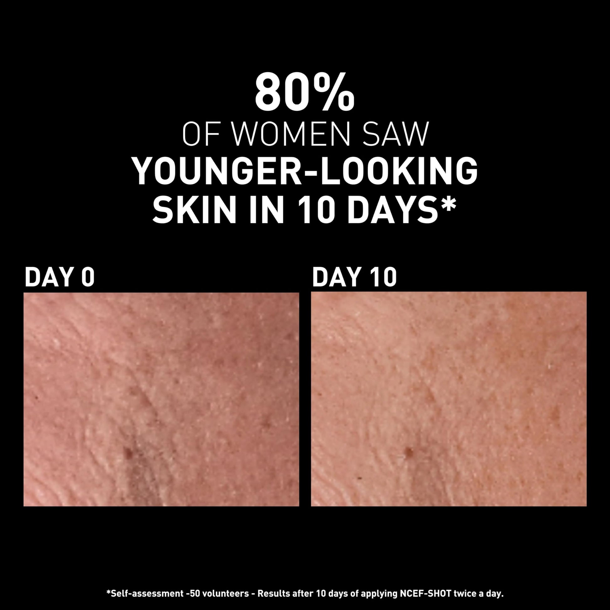 Concentrado Polirevitalizante Filorga Ncef 15ml