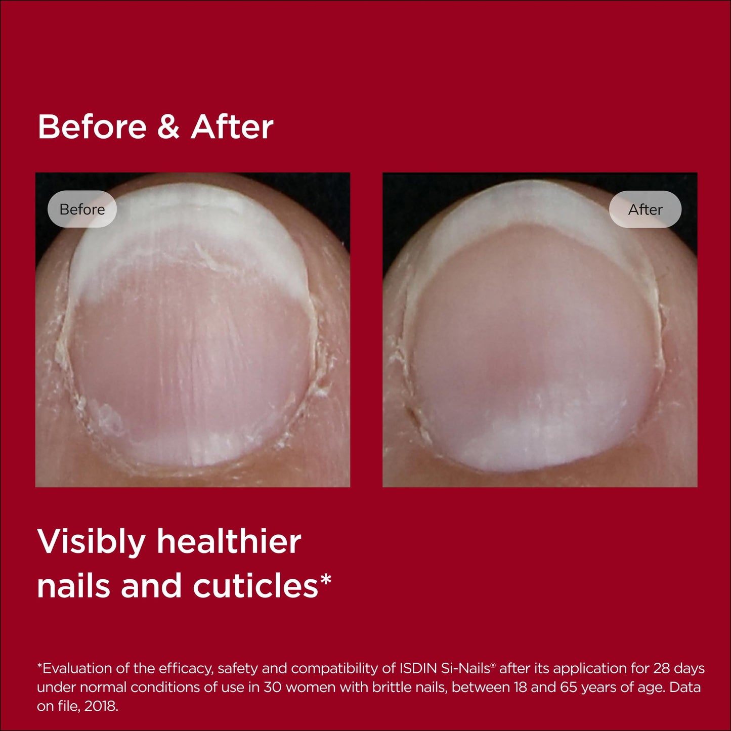ISDIN SI-NAILS - Tratamiento de suero para cutículas con ácido hialurónico