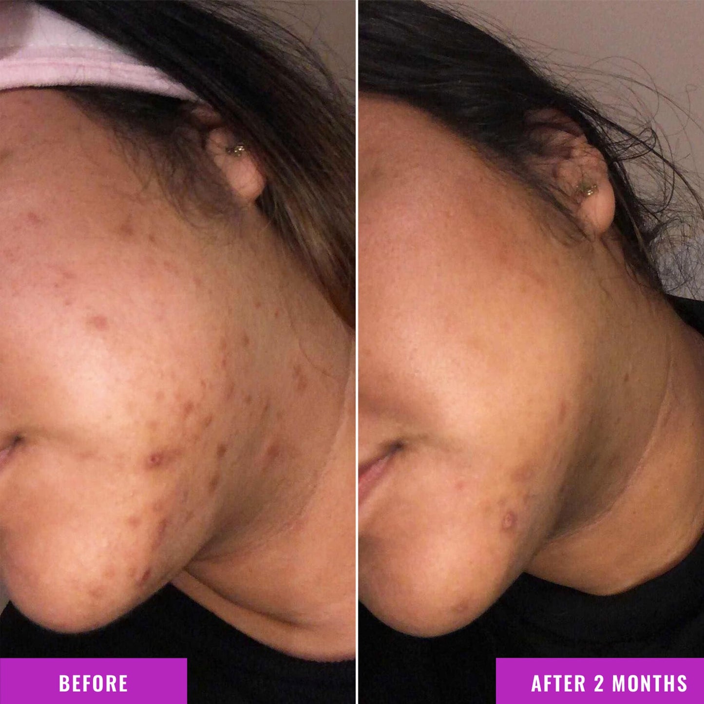 Sérum Corrector de Manchas Good Molecules 75ml para Hiperpigmentación y Marcas de Acné Vegano