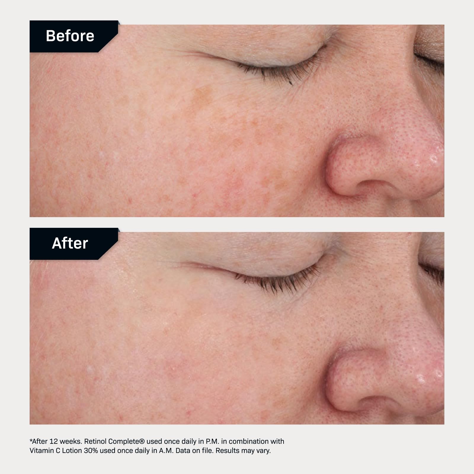 Retinol Complete 0.5% Revision Skincare 1 oz